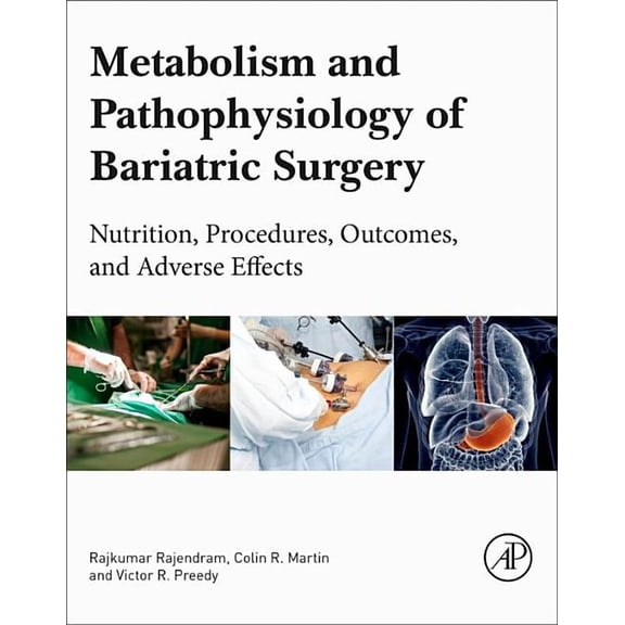 Metabolism and Pathophysiology of Bariatric Surgery: Nutrition, Procedures, Outcomes and Adverse Effects, (Paperback)