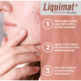 thumbnail image 6 of Liquimat Acne Treatment & Cover Up Lotion, Gentle Formula, 1.50oz, 6 of 7