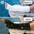 thumbnail image 7 of COEQINE Galaxy Sun Moon Leg Cast Cover 2 Pack Outdoor Protection Leg Cover Leg Plaster Sleeve Medium Reusable Cast Covers for Shower Leg Short Foot Cast Cover Gifts for Friends, 7 of 7
