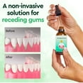 thumbnail image 2 of Gum Regrowth Drops, Gum Treatment for Receding Gums, Oil Pulling for Teeth and Gums, Rejuvenate Your Gums with Ease 3pcs, 2 of 6