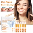 thumbnail image 1 of Fiudx Ampolla para Cuidado Bucal, Suero Blanqueador Reparador, Gel para El Control Del Sarro, Potenciador de La Salud de Las Encías, Ayuda para El Cepillado Diario, Solución para Dientes Sensibles, R, 1 of 7