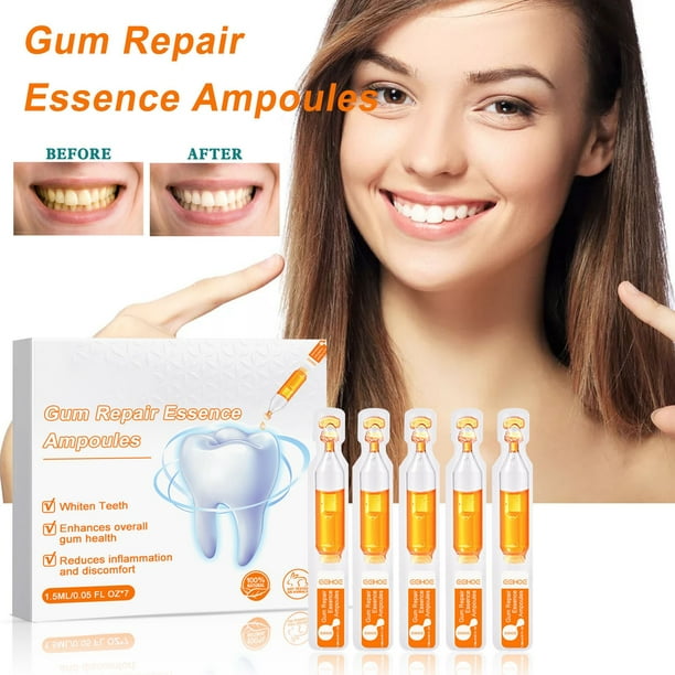 Fiudx Ampolla Blanqueadora Dental, Potente Gel para Eliminar El Sarro, Fórmula Reparadora para Dientes Sensibles, Pasta Dental para El Control de Placa, Solución para El Cuidado Bucal, Uso En Adultos