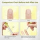 thumbnail image 4 of Aceite para uñas fortalecedor, hidratante y fortalecedor, para manicura, lápiz nutritivo, anticolgantes, para eliminar los bordes de las uñas, 2 ml, 4 of 5