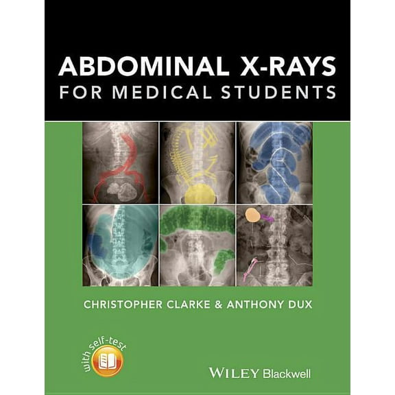 Abdominal X-Rays for Medical Students, (Paperback)