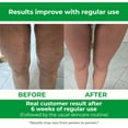 thumbnail image 4 of TESMED Cellulite Manual Massager : Made in Italy, Patented with Converging & Diverging Roller Technology. Anti Cellulite Roller for Thighs and Buttock, 4 of 9