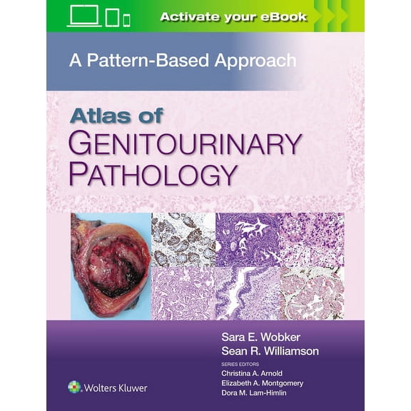 Atlas of Genitourinary Pathology: A Pattern Based Approach (Hardcover)