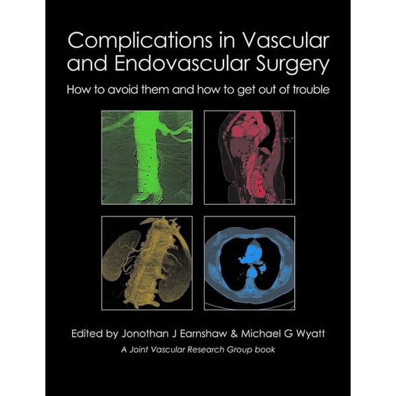 Complications in Vascular and Endovascular Surgery: How to Avoid Them and How to Get Out of Trouble (Hardcover)
