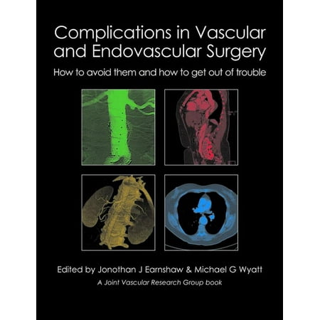 UPC: 9781903378809 | Complications in Vascular and Endovascular Surgery: How to Avoid Them and How to Get Out of Trouble (Hardcover)