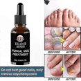 thumbnail image 4 of Advanced Nail Care Solution for Fungus Repair and Cuticle Health Treatment Oil, 4 of 4