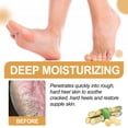 thumbnail image 3 of Fankiway Foot Callus Remover Spray Improve Dryness And Roughness, And Replenish Skin With Moisturing 30ml, Beauty & Personal Care, 3 of 8