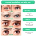 thumbnail image 3 of Máscara de ojos BREYLEE con aloe vera, ojos hinchados y ojeras, 60 unidades, 3 of 7