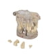 thumbnail image 1 of Consumibles dentales, modelo de restauración dental extraíble, modelo de diente patológico, modelo de diente móvil, modelo dental de implante, 1 of 4