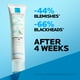 thumbnail image 5 of Crema para el tratamiento del acné La Roche-Posay Effaclar Duo+M 40 ml, 5 of 9