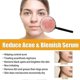 thumbnail image 4 of Jaysuing anti-acne and anti-pimple serum |, 4 of 5