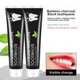 thumbnail image 5 of Bilqis Charcoal Black Toothpaste Whitens Teeth Removes Yellowness And Removes Bad Breath, 5 of 8