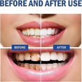 thumbnail image 3 of Sp 9 Toothpaste SP-9 Probiotic Toothpaste Sp9 Pasta Dental Teeth Whitening Care Toothpaste Stain Removal Deep Cleaning Fresh Breath--1pc, 3 of 5