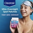 Clearasil Overnight Spot Patches, Advanced Healing Hydrocolloid Acne Pimple Treatment, Blemish