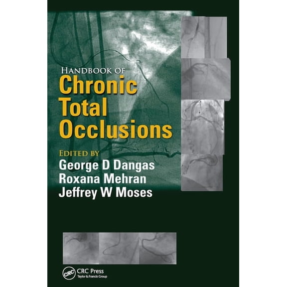 Handbook of Chronic Total Occlusions, (Paperback)