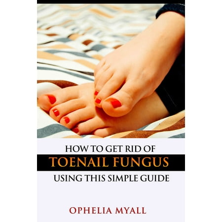 How to Get Rid of Toenail Fungus Using This Simple Guide - (Best Way To Get Rid Of Toenail Fungus Naturally)