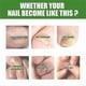 thumbnail image 2 of Nail Care Roller Ball Massager for Stronger, Faster-Growing Nails with 7-Day Formula, 2 of 5