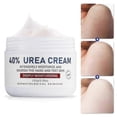 thumbnail image 2 of Crema de urea para pies, crema de urea al 40 % para talones agrietados y piel seca, hidratación profunda, eliminador de callos., 2 of 5