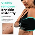 thumbnail image 3 of Dermasuri Deep Exfoliating Mitt Body Scrub, 3 of 9