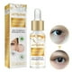 thumbnail image 1 of Suero para Ojos 30 ML Milia Remover Ayuda A Disolver Y Suavizar Mujeres Rojo, 1 of 9