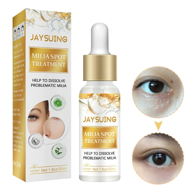 Suero para Ojos 30 ML Milia Remover Ayuda A Disolver Y Suavizar Mujeres Rojo