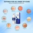 thumbnail image 4 of Nongting Advanced Silicone Scar Gel For Scar Scar Removal Solution For Marks Stretch Marks Keloids, 4 of 5