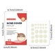 thumbnail image 2 of Parches medicinales para el acné para todo tipo de piel, adhesivos para la cara y la piel para eliminar espinillas y espinillas, 72 unidades, 2 of 4