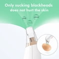 thumbnail image 2 of Electric Acne Remover Machine Nose Blackhead Vacuum Extractor Tool Skin Care Face Pore Cleaner, 2 of 8