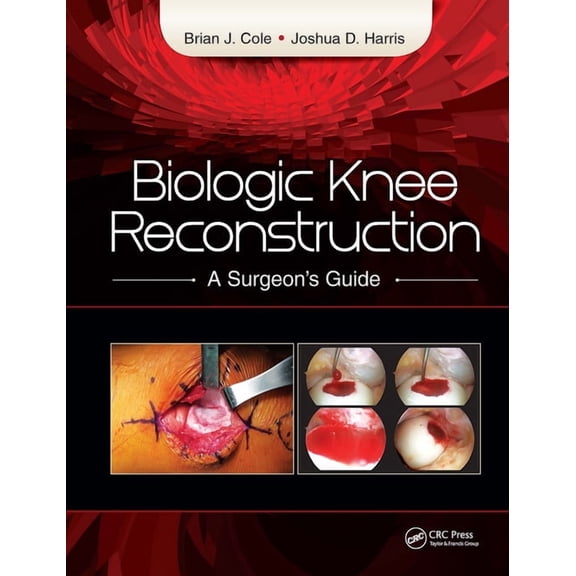 Biologic Knee Reconstruction: A Surgeon's Guide, (Hardcover)