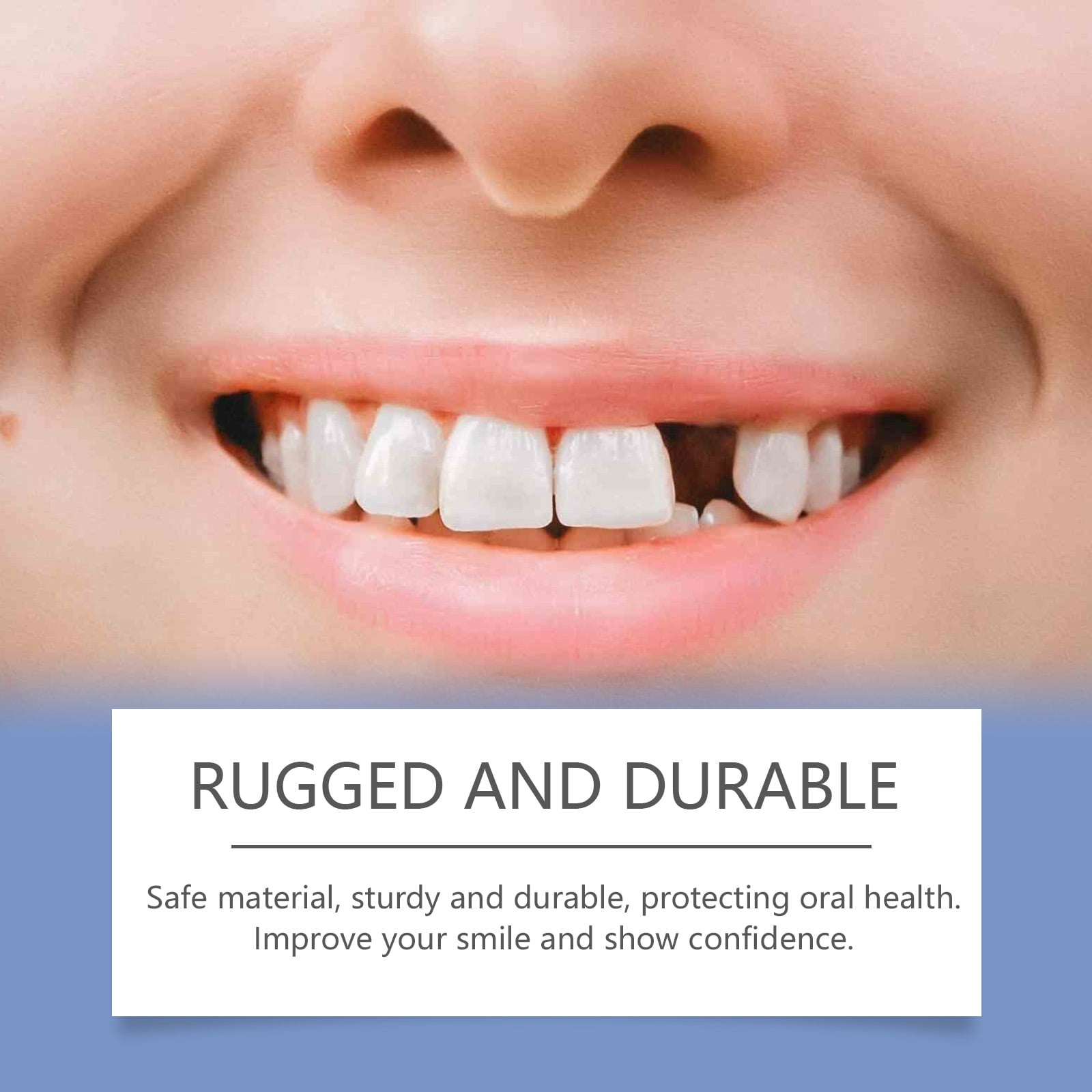 Alvantor Dental Care Kit Tooth Repair Moldable Filling for Missing Broken Teeth Gaps, White