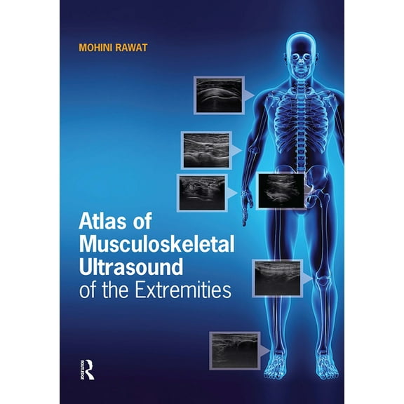 Atlas of Musculoskeletal Ultrasound of the Extremities, (Paperback)