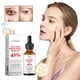 thumbnail image 1 of Fiudx Liquidación De Ahorros De Verano Exfoliante Exfoliante Super Exfoliante Pigmentación Iluminador Antienvejecimiento 30Ml, 1 of 6