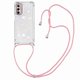 thumbnail image 1 of Funda FOXDOCK para Motorola Moto G Stylus 2022 5G con Cuerda Ajustable, Brillo Líquido, Protección Antigolpes y Lente – Ideal para Regalo, 1 of 6