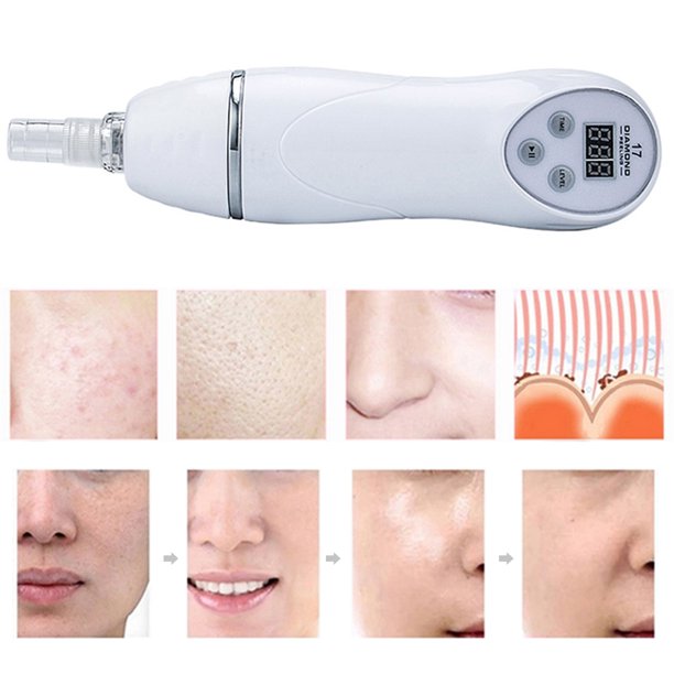 Yixx Microdermabrasion Dermabrasion Machine Vacuum Peeling Skin