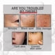 thumbnail image 2 of 2pcs Collagen Boost Anti-aging Serum, Collagen Boost Anti-aging Serum, Collagen Boost, Collagen Boost Cream, 2 of 4