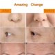 thumbnail image 5 of Rodillo eléctrico para ojos 3 en 1 - Juego de masajeador facial Herramienta antiarrugas antienvejecimiento para arrugas, líneas finas, círculos oscuros y ojos hinchados Xemadio FLD-4710, 5 of 6
