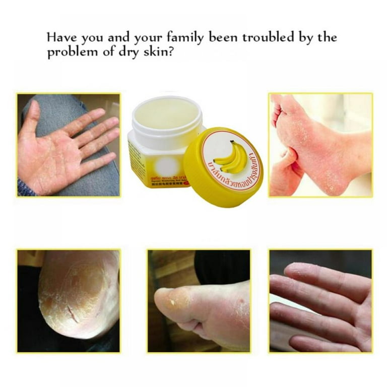 Anti-Drying Natural Banana Dead Skin Remover Soften Skin Crack