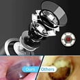 thumbnail image 2 of Ear Otoscope, HD Visual Ear Endoscope Camera with 6 LED Dimmable Light, Adults Kids Pets Ear Cleaning Kit for Android, Tablet and PC, 2 of 5