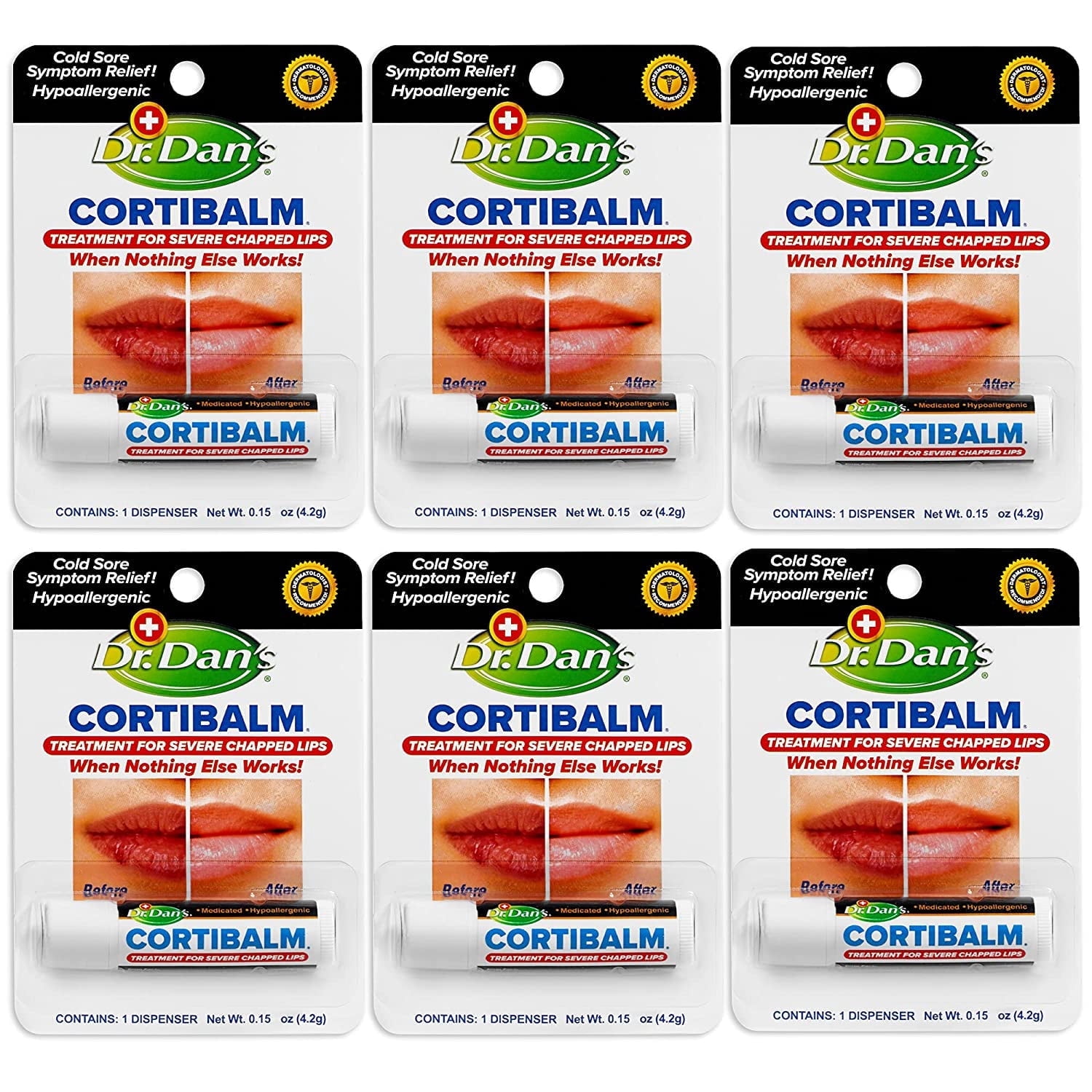 Dr. Dan's CortiBalm Medicated Lip Balm with 1% Hydrocortisone for Dry, Chapped Lips, 0.25 oz, 6 Count