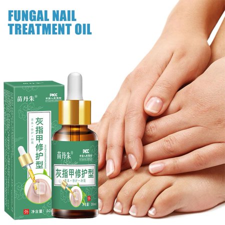 Fungal Nail Fungus Treatment Damaged Discoloration Nail Cuticles Relief