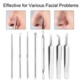 Blackhead Removal Tool Comedone Popper Acne Tweezers Ingrown Hair