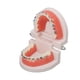 thumbnail image 2 of Modelo de dientes de tipodonto dental con soporte de metal de ortodoncia para la enseñanza de dentistas, investigación y laboratorio dental, 2 of 15