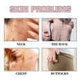 thumbnail image 2 of Rodillo para el Acne Eelhoe shaofei cuidado de la piel 4087128583772, 2 of 5