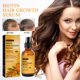thumbnail image 1 of Xihbxyly mi pedido Cabello denso, anticaída, cabello fijo, hidratante, cabello denso 60 ml, 1 of 7
