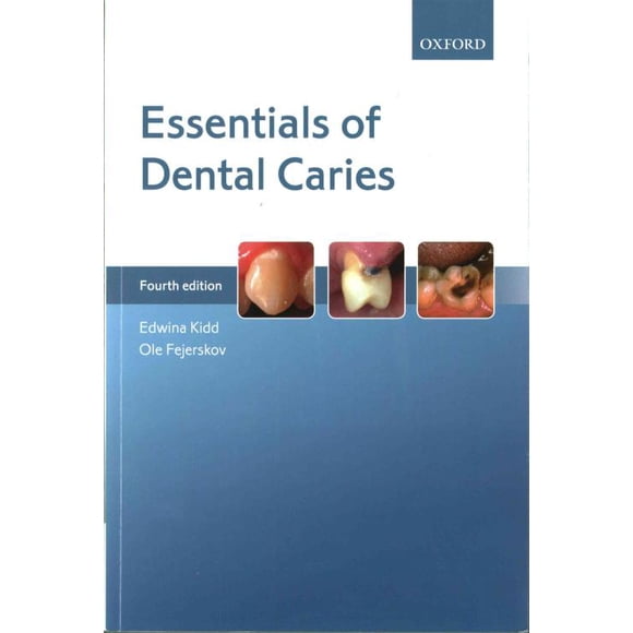 Essentiels de Caries Dentaires, Ole Fejerskov, Edwina Kidd Broché