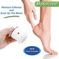 thumbnail image 2 of Removedor eléctrico de callos y piel muerta, amoladora, motorizada, aspiradora integrada, recargable por USB, doble velocidad para pies, blanco, 2 of 5