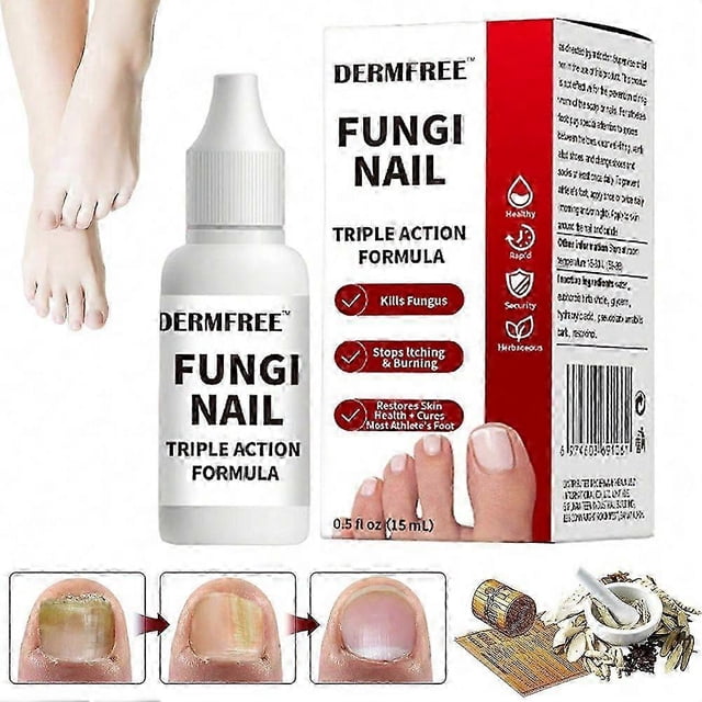 15ml Fungi Nail Treatment Liquid Fast-Acting Nail Repair Strengthening Liquid Nails Care Supplies